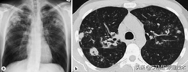 ct是什么意思（CTRL是什么意思网络用语）